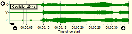 1. Preview chart